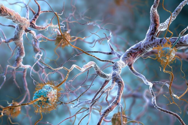 Illustration. Illustration d'un réseau de neurones avec des plaques et des enchevêtrements.