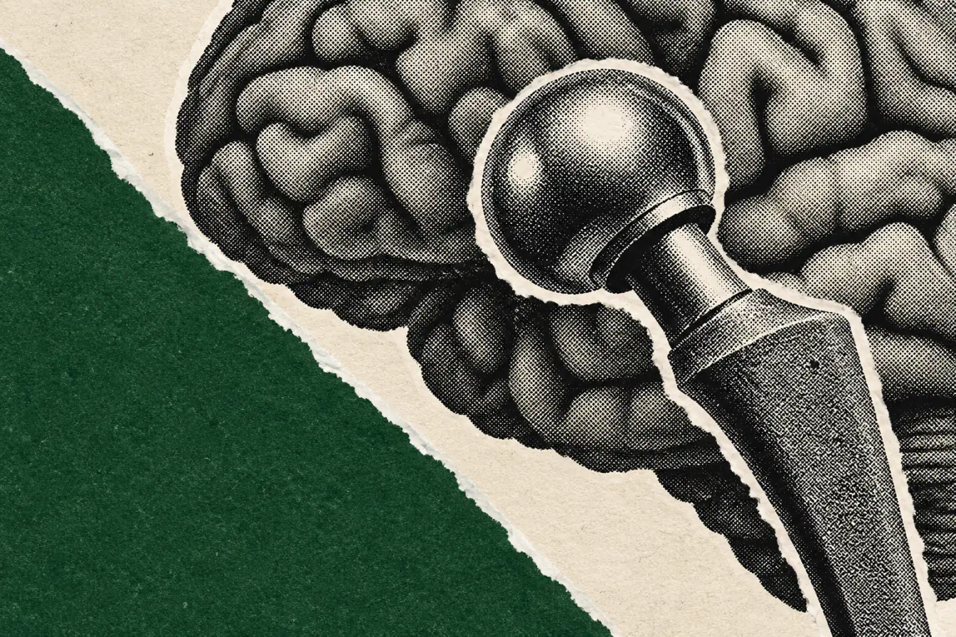 Cerveau traversé par une prothèse